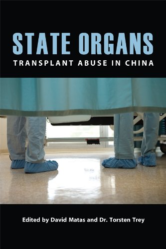 State Organs cover Amazon